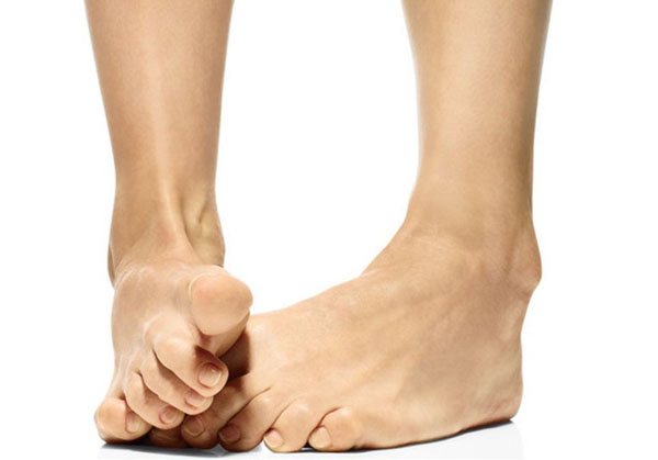 Лечение артроза пальцев ног​